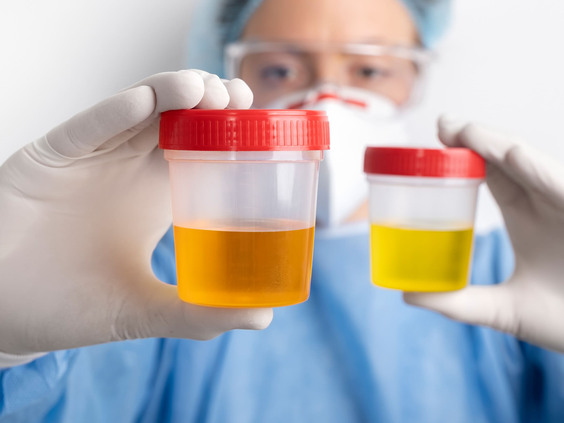 Programas de detección de drogas en el trabajo